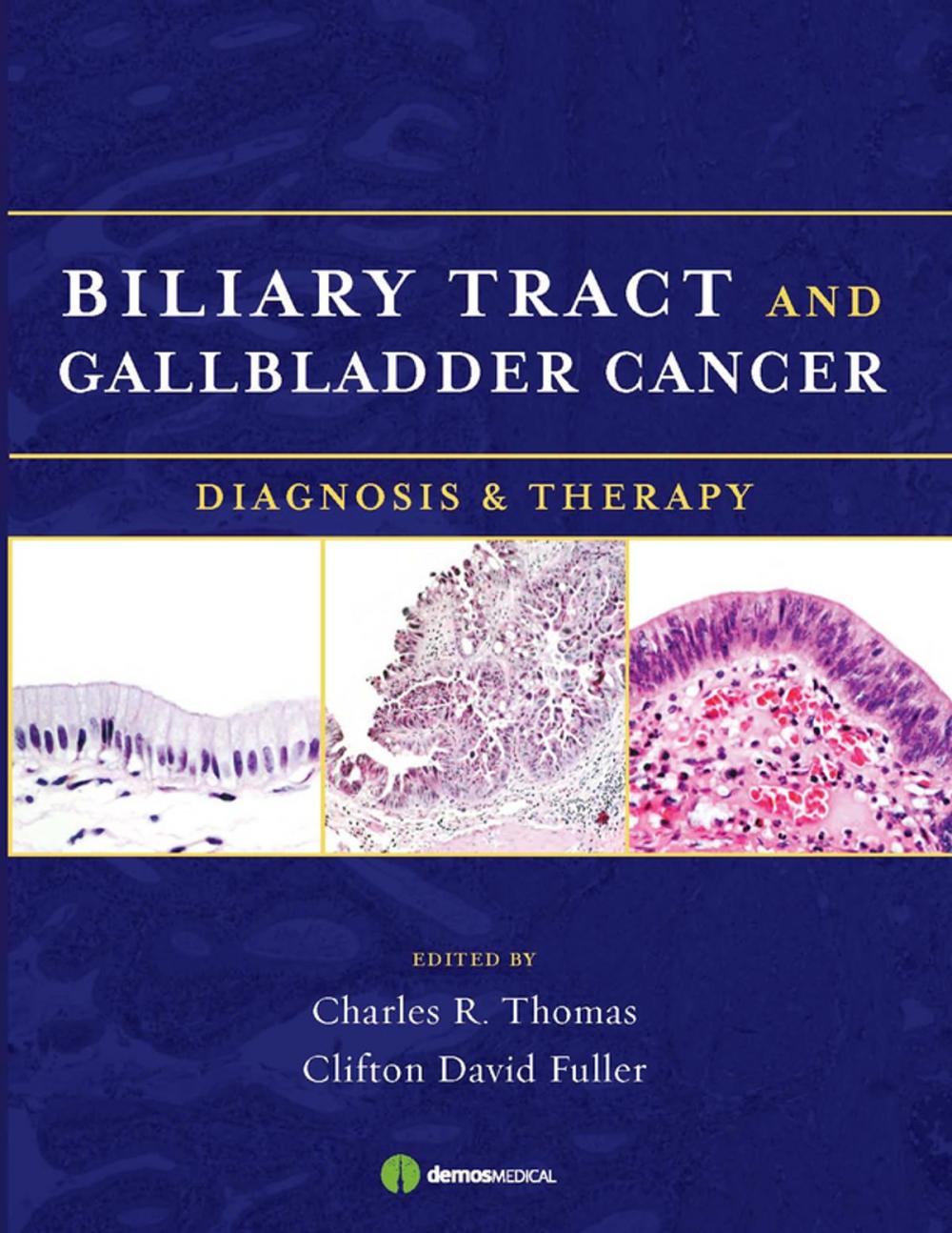 Big bigCover of Biliary Tract and Gallbladder Cancer