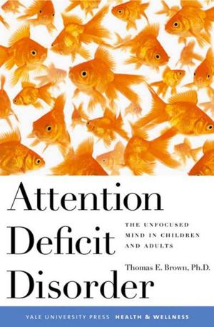 Cover of the book Attention Deficit Disorder: The Unfocused Mind in Children and Adults by Candida R. Moss