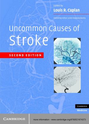Cover of the book Uncommon Causes of Stroke by 