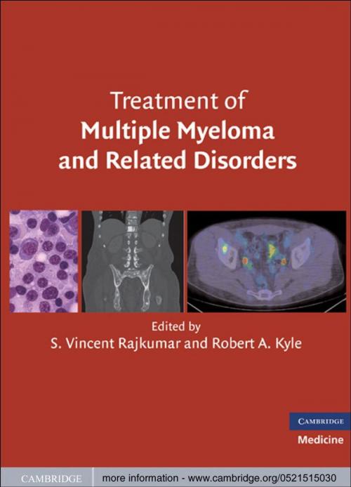 Cover of the book Treatment of Multiple Myeloma and Related Disorders by , Cambridge University Press