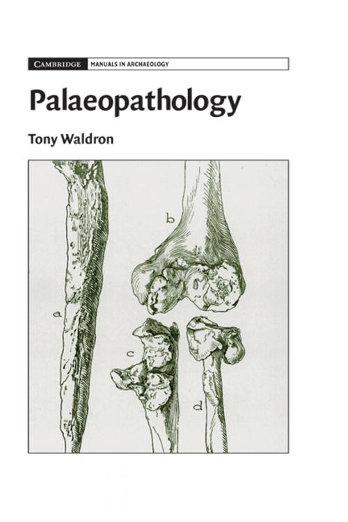 Cover of the book Palaeopathology by Tony Waldron, Cambridge University Press