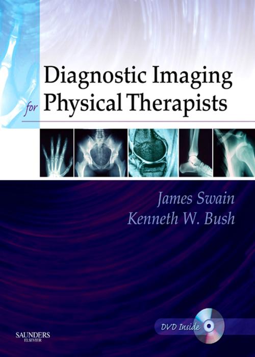 Cover of the book Diagnostic Imaging for Physical Therapists - E-Book by James Swain, MPT, Kenneth W. Bush, MPT, Phd, Juliette Brosing, PhD, Elsevier Health Sciences