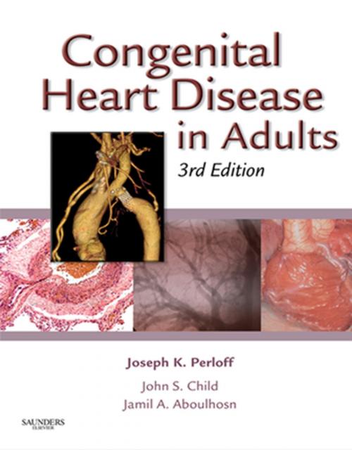 Cover of the book Congenital Heart Disease in Adults E-Book by John S. Child, MD, FACC, Joseph K. Perloff, MD, Jamil Aboulhosn, Elsevier Health Sciences