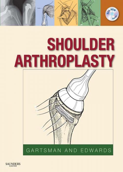 Cover of the book Shoulder Arthroplasty E-Book by Gary M. Gartsman, MD, T. Bradley Edwards, MD, Elsevier Health Sciences