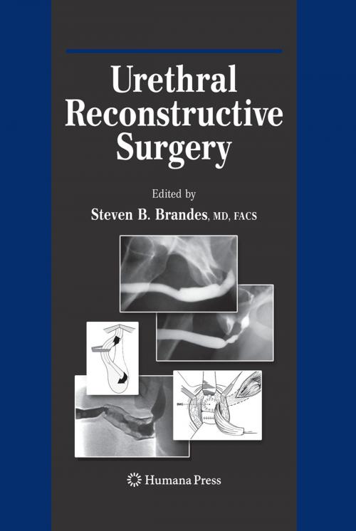 Cover of the book Urethral Reconstructive Surgery by , Humana Press