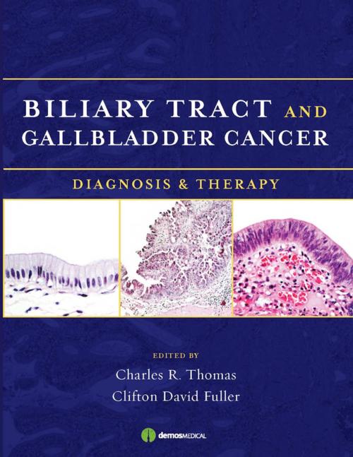 Cover of the book Biliary Tract and Gallbladder Cancer by Clifton D. Fuller, MD, Charles R. Thomas, MD, Springer Publishing Company