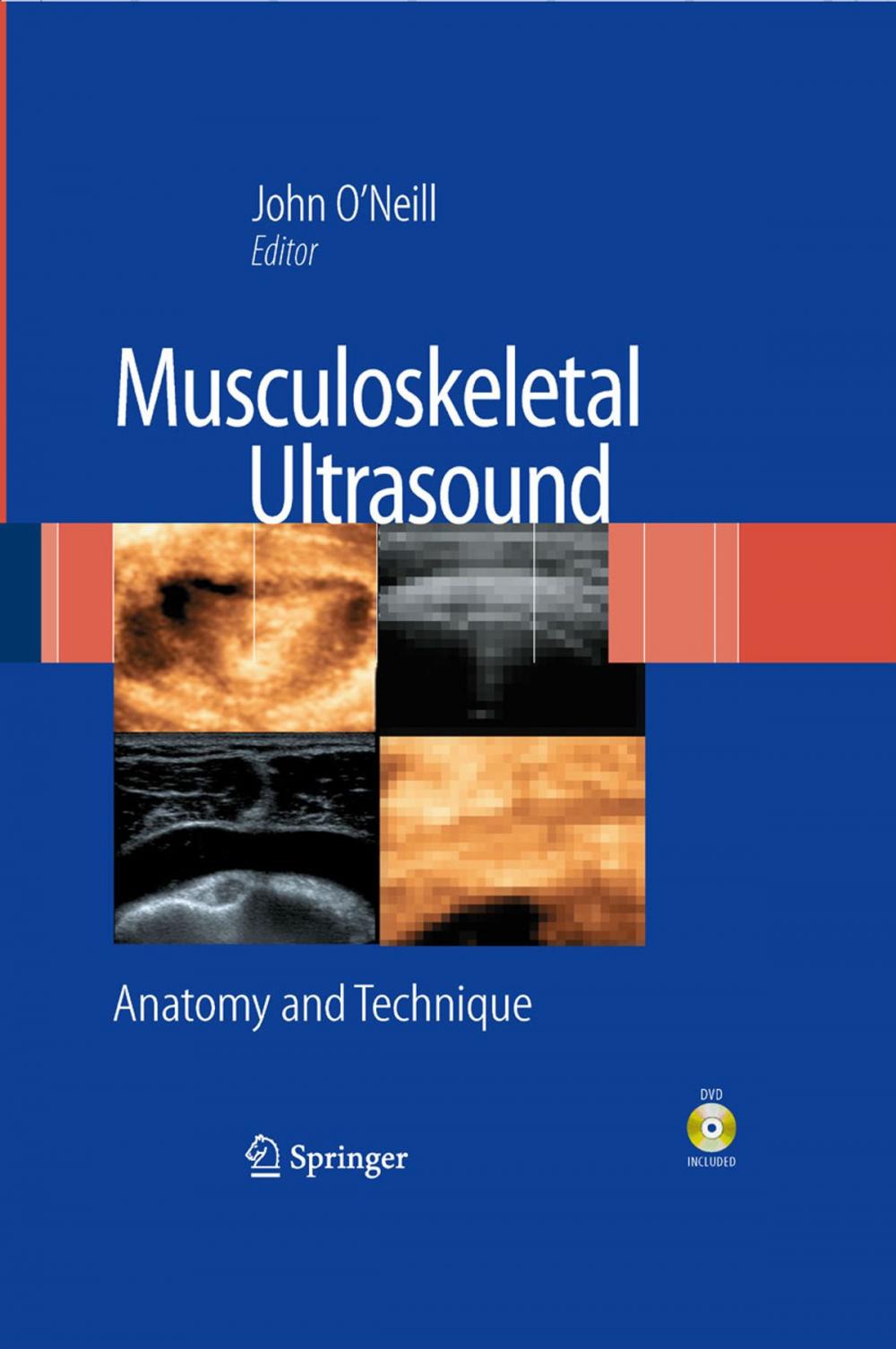 Big bigCover of Musculoskeletal Ultrasound