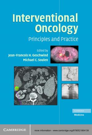 Cover of the book Interventional Oncology by Professor David Ohana