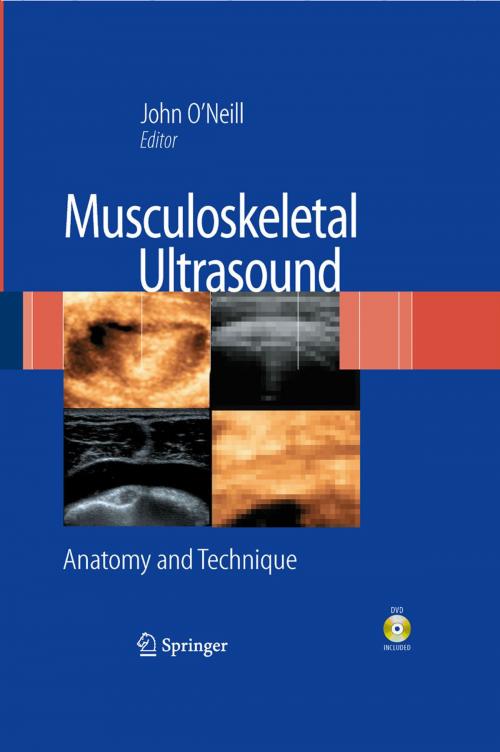 Cover of the book Musculoskeletal Ultrasound by , Springer New York
