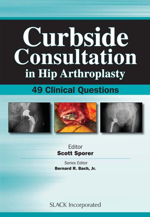 Cover of the book Curbside Consultation in Hip Arthroplasty by , SLACK Incorporated