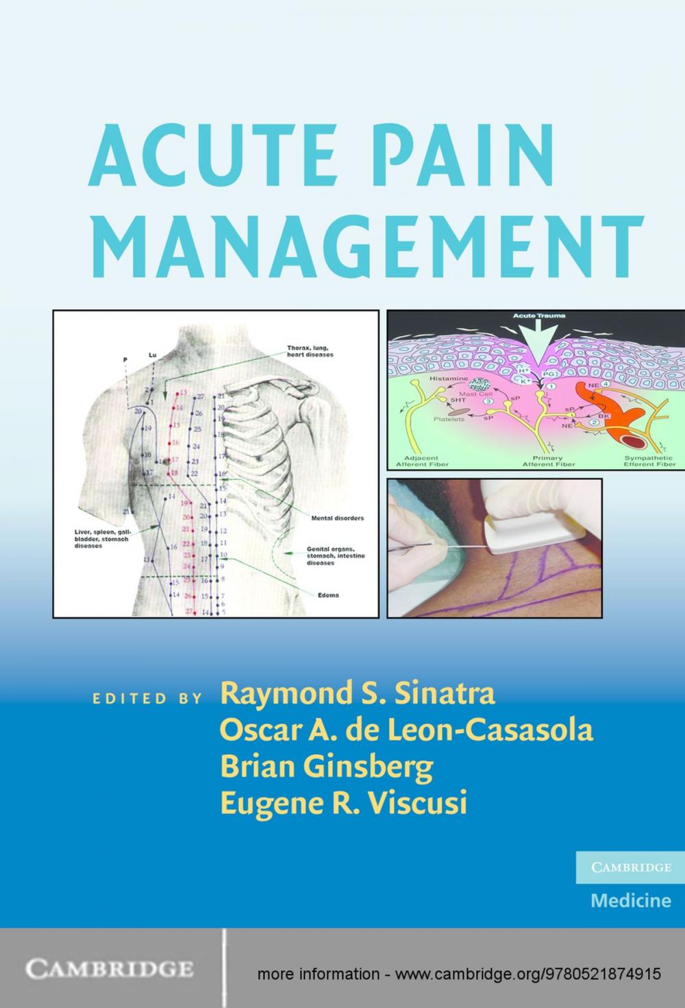 Big bigCover of Acute Pain Management