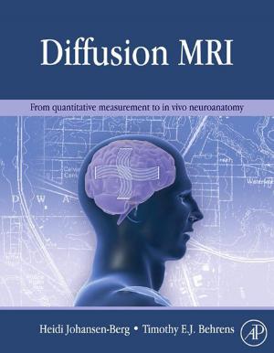 Cover of the book Diffusion MRI by Jeffery L Casper, William A Atwell