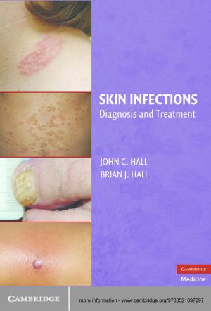 Cover of the book Skin Infections by Rod Sinclair, MBBS, FACD, MD, Vicky Jolliffe, MA FRCP FRCS(Ed) MRCGP