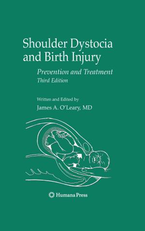 Cover of the book Shoulder Dystocia and Birth Injury by Joseph A. Prahlow