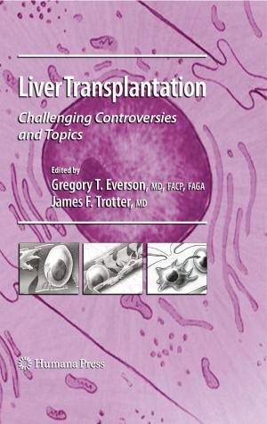 bigCover of the book Liver Transplantation by 