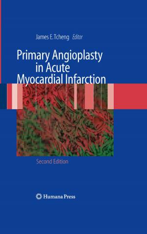 Cover of the book Primary Angioplasty in Acute Myocardial Infarction by David Naor, Benjamin Y. Klein, Nora Tarcic, Jonathan S. Duke-Cohan