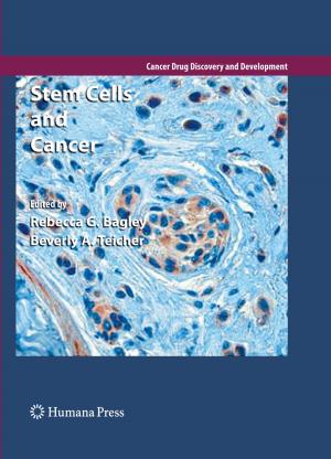 Cover of the book Stem Cells and Cancer by 