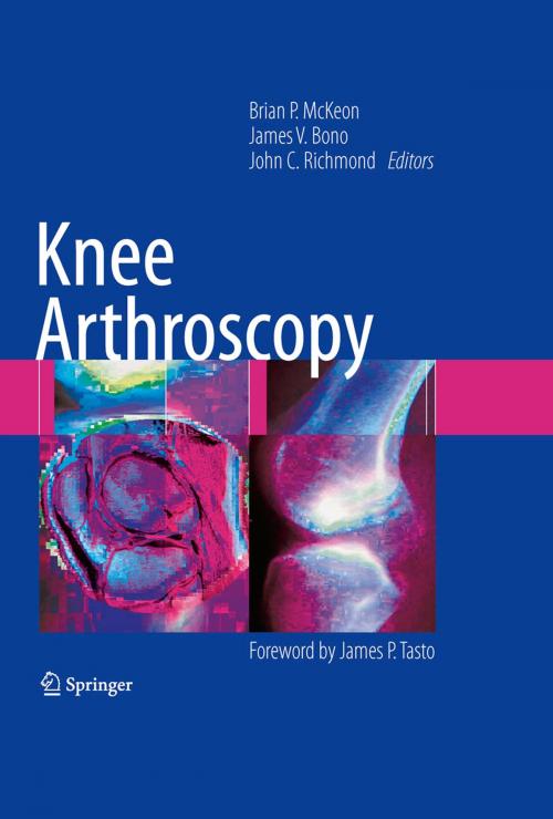 Cover of the book Knee Arthroscopy by , Springer New York