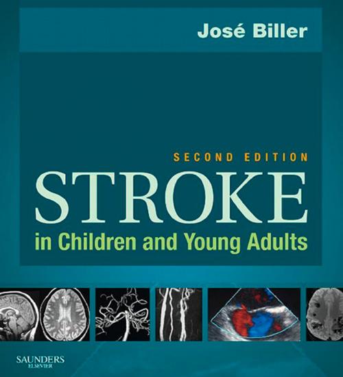 Cover of the book Stroke in Children and Young Adults E-Book by José Biller, Elsevier Health Sciences