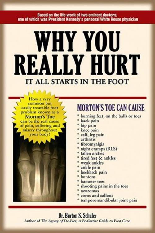 Cover of the book Why You Really Hurt: Its All In The Foot by Dr. Burton S. Schuler, Cardinal Publishers Group