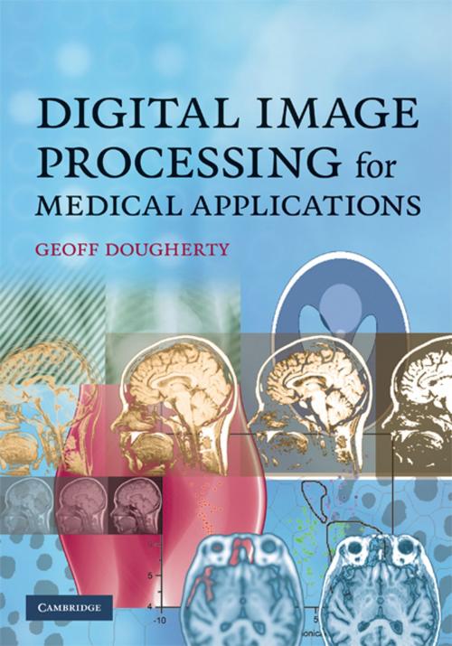 Cover of the book Digital Image Processing for Medical Applications by Geoff Dougherty, Cambridge University Press