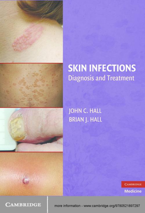 Cover of the book Skin Infections by Brian J. Hall, Cambridge University Press