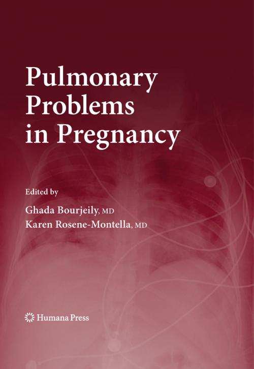 Cover of the book Pulmonary Problems in Pregnancy by , Humana Press