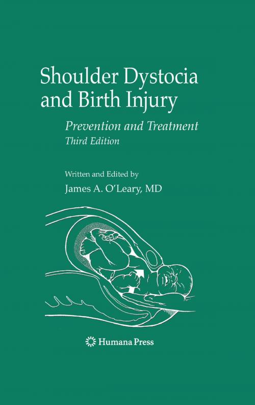 Cover of the book Shoulder Dystocia and Birth Injury by , Humana Press