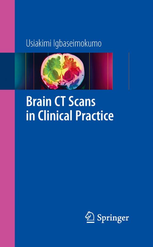 Cover of the book Brain CT Scans in Clinical Practice by Usiakimi Igbaseimokumo, Springer London