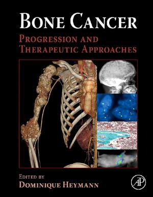 Cover of the book Bone Cancer by Geoffrey Michael Gadd, Sima Sariaslani