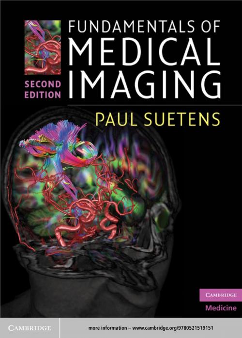 Cover of the book Fundamentals of Medical Imaging by Paul Suetens, Cambridge University Press