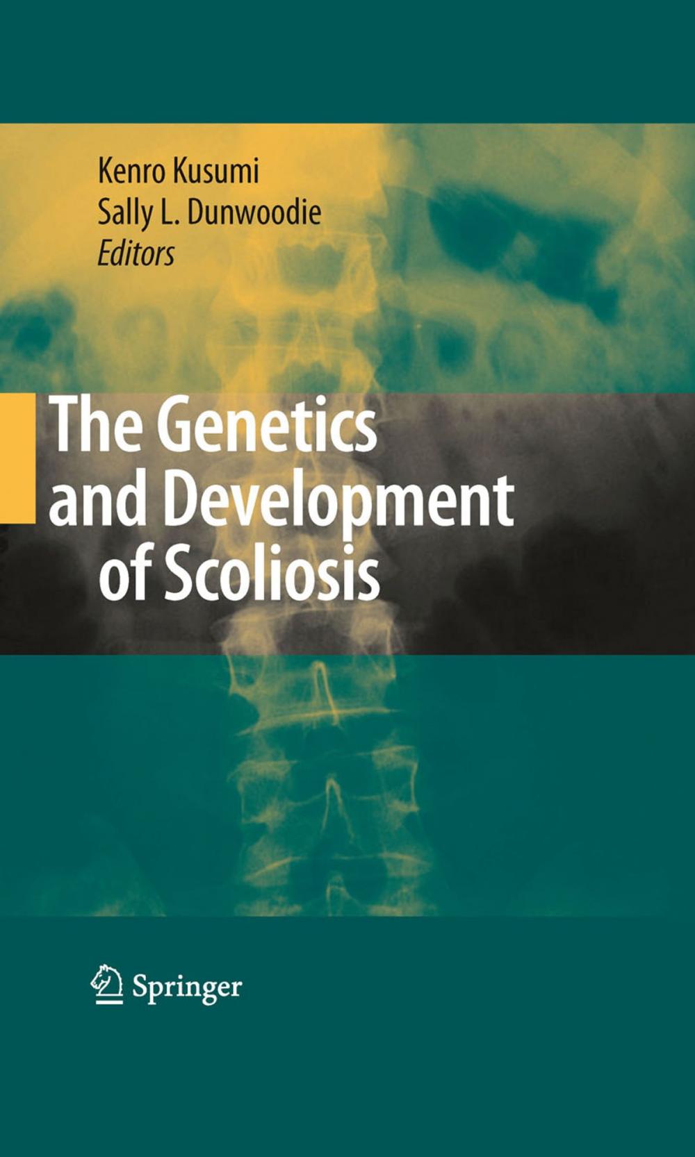 Big bigCover of The Genetics and Development of Scoliosis