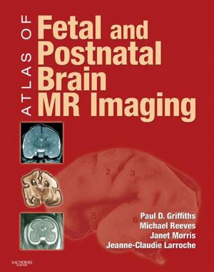 Book cover of Atlas of Fetal and Infant Brain MR