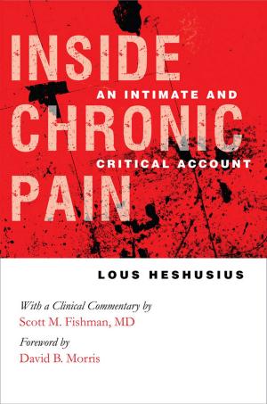 Book cover of Inside Chronic Pain