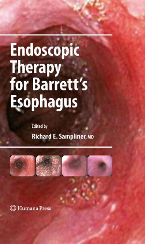 Cover of the book Endoscopic Therapy for Barrett's Esophagus by David Cope