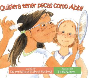 Book cover of Quisiera tener pecas como Abby