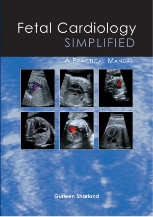 Cover of the book Fetal Cardiology Simplified by Moshe Schein