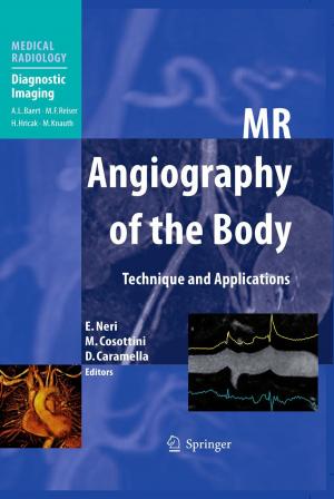 Cover of the book MR Angiography of the Body by C. Andre, M. Spehl-Robberecht, F.-E. Avni, F. Brunelle, L. Cadier, J.-Y. Cohen, A. Couture, P. Devred, M. Dewald, D. Eurin, J.-L. Ferran, L. Garel, G. Lalande, D. Lallemand, B. Le Bihan, P. Le Dosseur, J. Leclere, J.-P. Montagne, S. Neuenschwander, D. Pariente, J. Poncin