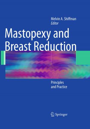 Cover of the book Mastopexy and Breast Reduction by Angang Hu, Yilong Yan, Xing Wei