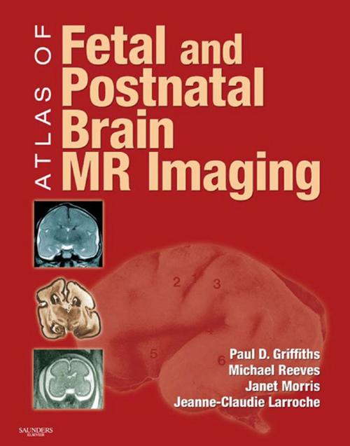 Cover of the book Atlas of Fetal and Infant Brain MR by Paul D. Griffiths, Janet Morris, Jeanne-Claudie Larroche, Michael Reeves, Elsevier Health Sciences