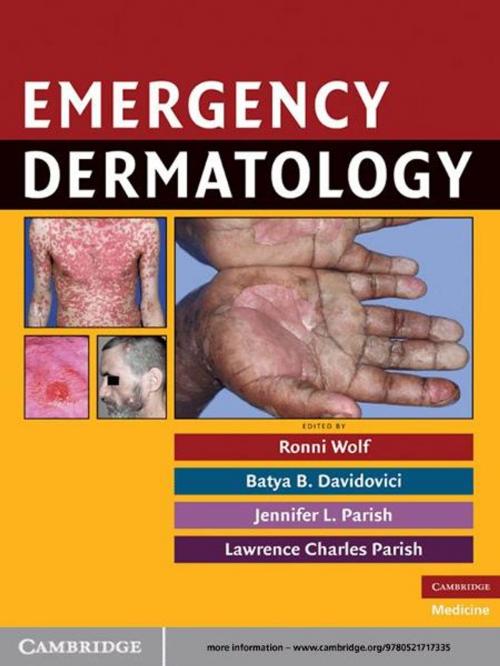 Cover of the book Emergency Dermatology by , Cambridge University Press