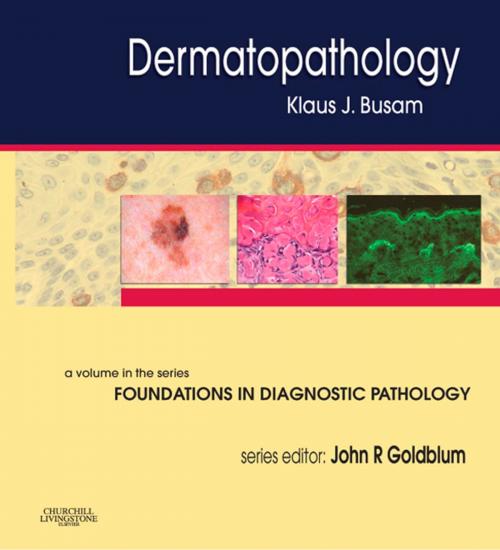 Cover of the book Dermatopathology E-Book by Klaus J. Busam, MD, John R. Goldblum, MD, FCAP, FASCP, FACG, Elsevier Health Sciences