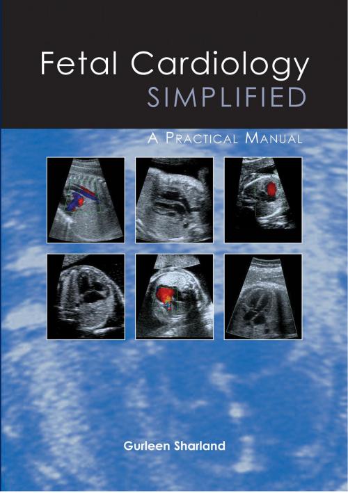 Cover of the book Fetal Cardiology Simplified by Gurleen Sharland, TFM Publishing Ltd