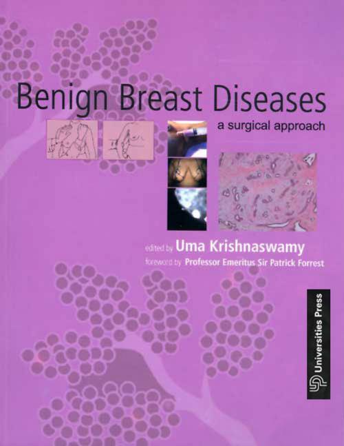 Cover of the book Benign Breast Diseases by Uma Krishnaswamy, Universities Press (India) Private Limited