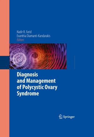 Cover of the book Diagnosis and Management of Polycystic Ovary Syndrome by Francky Catthoor, K. Danckaert, K.K. Kulkarni, E. Brockmeyer, Per Gunnar Kjeldsberg, T. van Achteren, Thierry Omnes