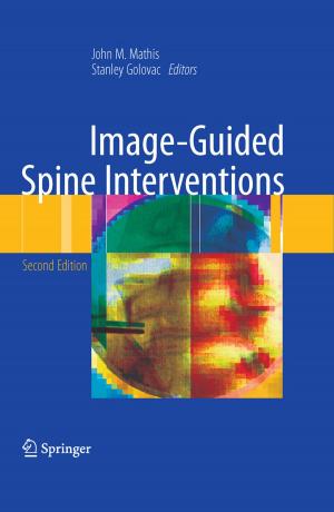 Cover of the book Image-Guided Spine Interventions by Thomas Rylander, Pär Ingelström, Anders Bondeson