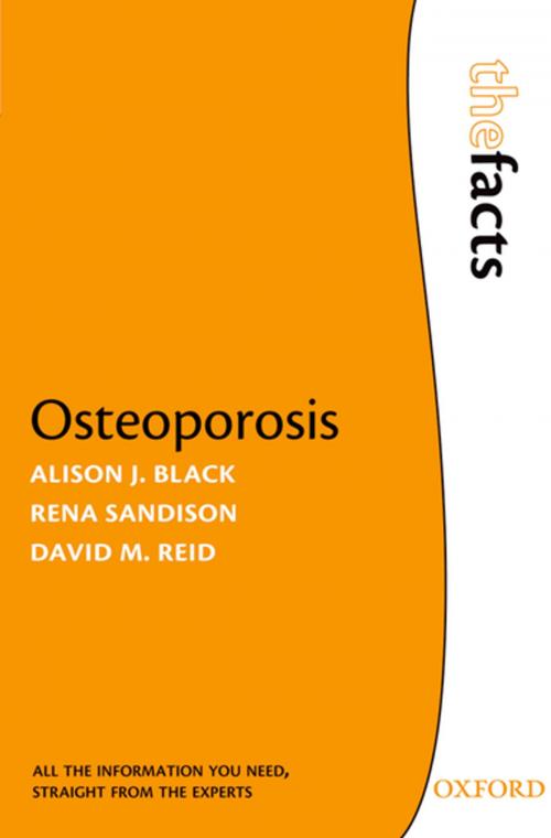 Cover of the book Osteoporosis by Alison J. Black, Rena Sandison, David M. Reid, OUP Oxford