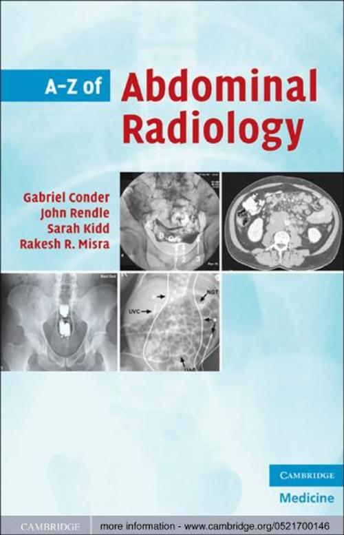 Cover of the book A-Z of Abdominal Radiology by Gabriel Conder, John Rendle, Sarah Kidd, Dr Rakesh R. Misra, Cambridge University Press