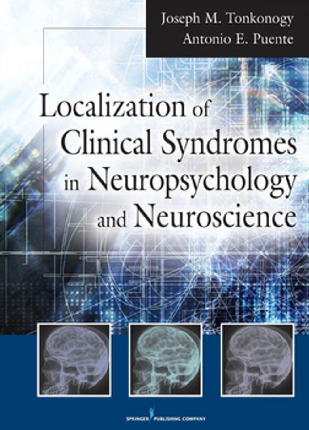 Big bigCover of Localization of Clinical Syndromes in Neuropsychology and Neuroscience