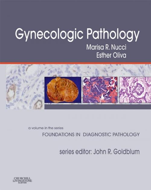 Cover of the book Gynecologic Pathology E-Book by Marisa R. Nucci, MD, Esther Oliva, MD, Elsevier Health Sciences